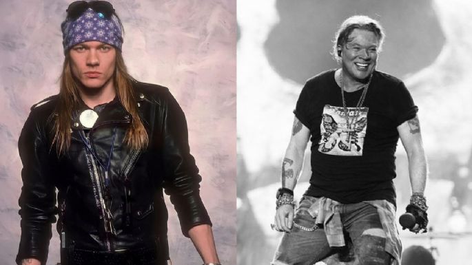 5 fotos de Axl Rose antes y después de Guns N Roses