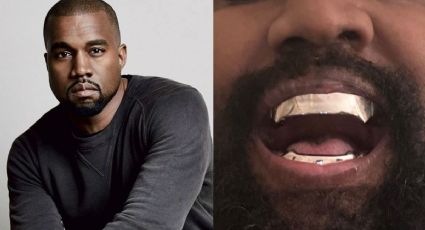 ¿Kanye West se quitó los dientes? aparece con dentadura de casi un millón de dólares