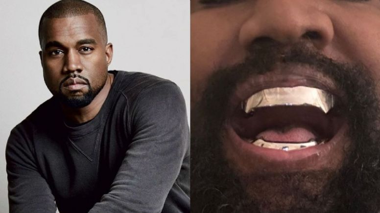 ¿Kanye West se quitó los dientes? aparece con dentadura de casi un millón de dólares