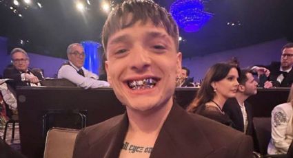 ¿Cuánto cuesta la dentadura de Peso Pluma? Así lucieron sus dientes en los Grammys 2024