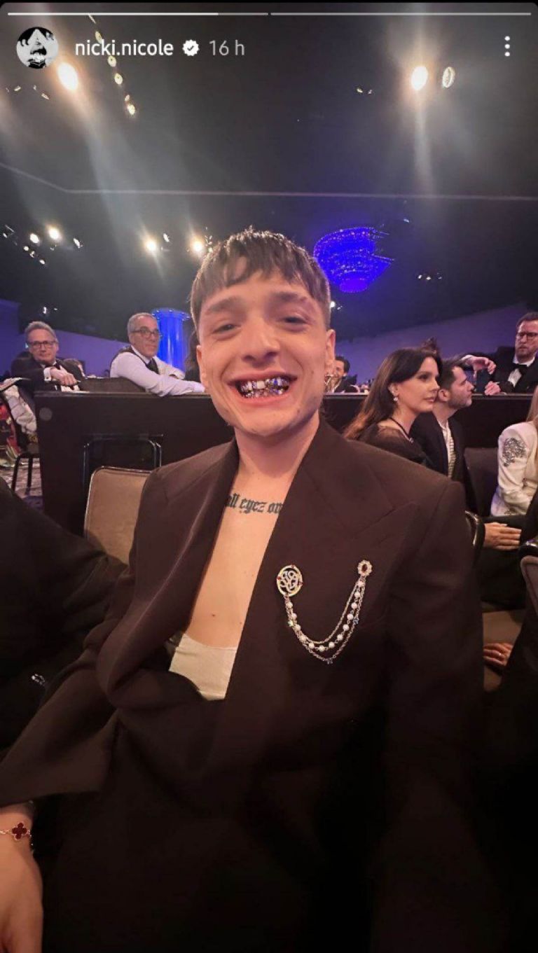 Peso Pluma luce sus dientes llenos de joyas en los Grammys 2024